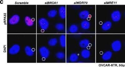 Immunocytochemistry/ Immunofluorescence: RPA2 [p Ser33] Antibody [NB100-544]